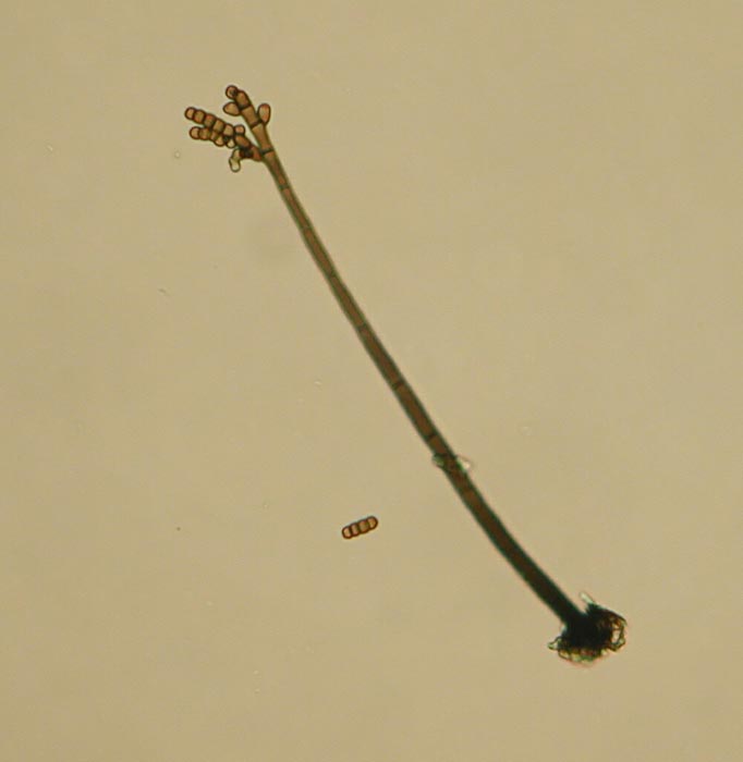macrostoma