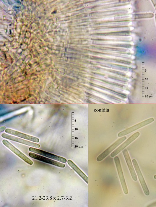 macrostoma