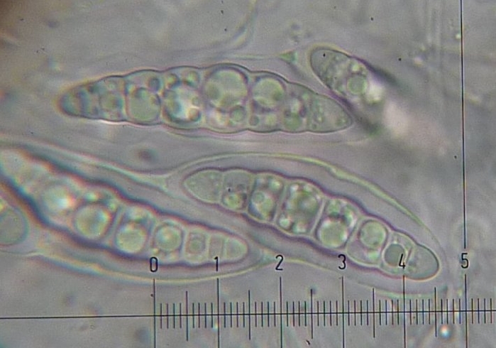 macrostoma