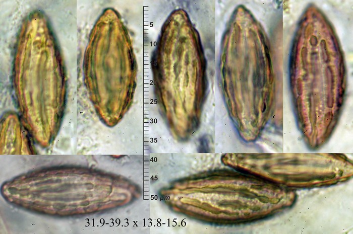 macrostoma