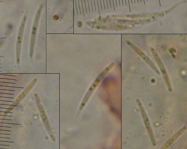 macrostoma