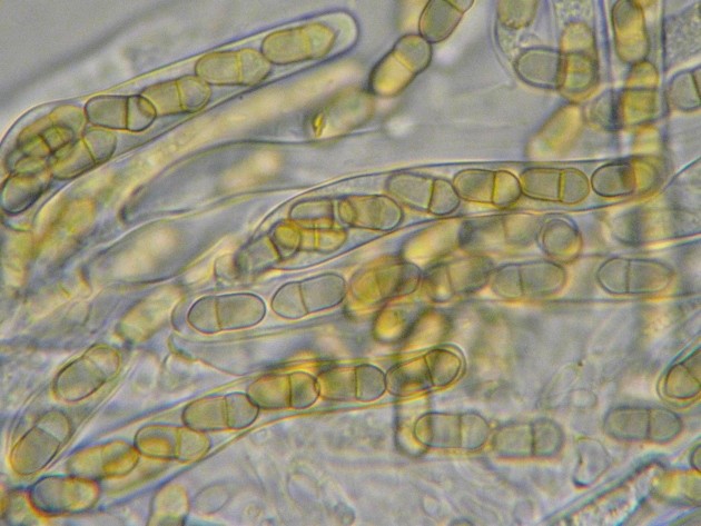 macrostoma