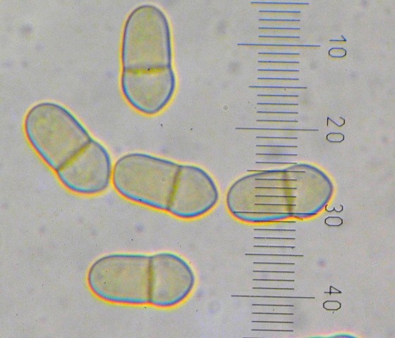 macrostoma