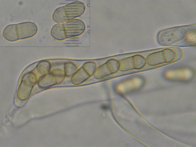 macrostoma