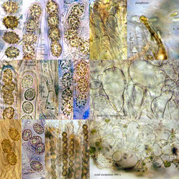 macrostoma