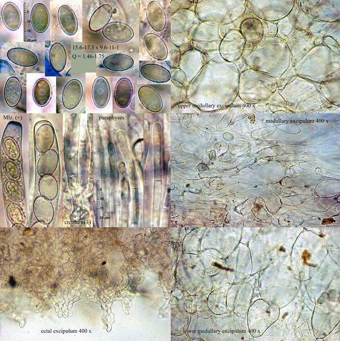 macrostoma