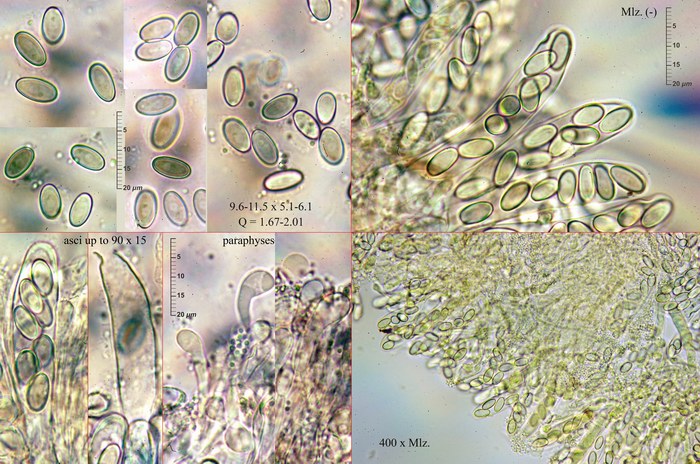 macrostoma