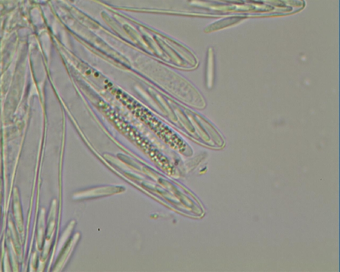 macrostoma
