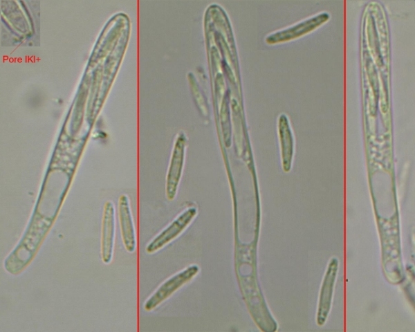 macrostoma
