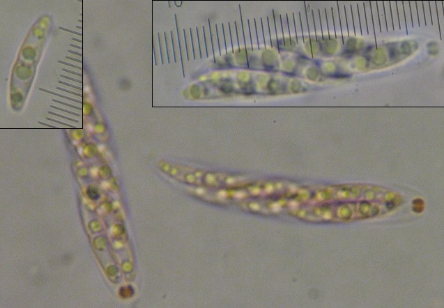 macrostoma