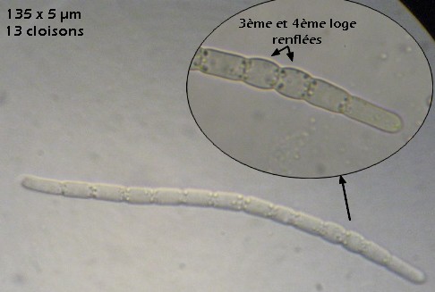 macrostoma