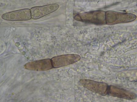 macrostoma