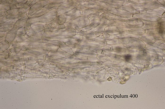 macrostoma