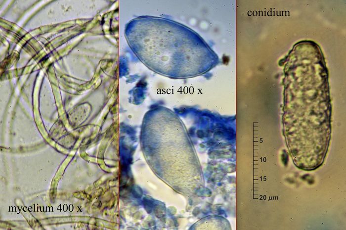 macrostoma