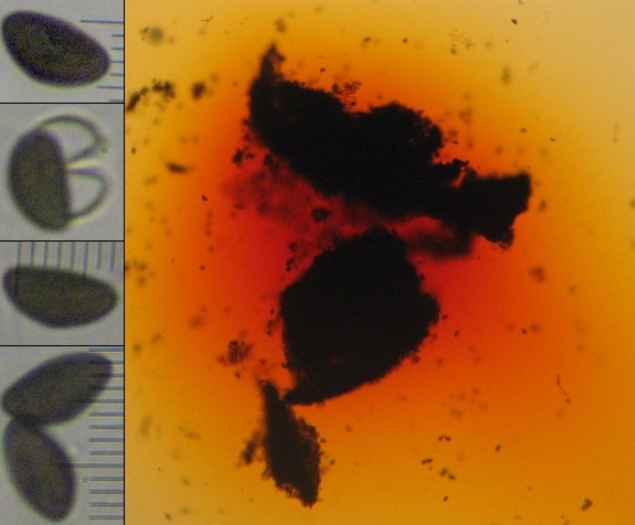 macrostoma