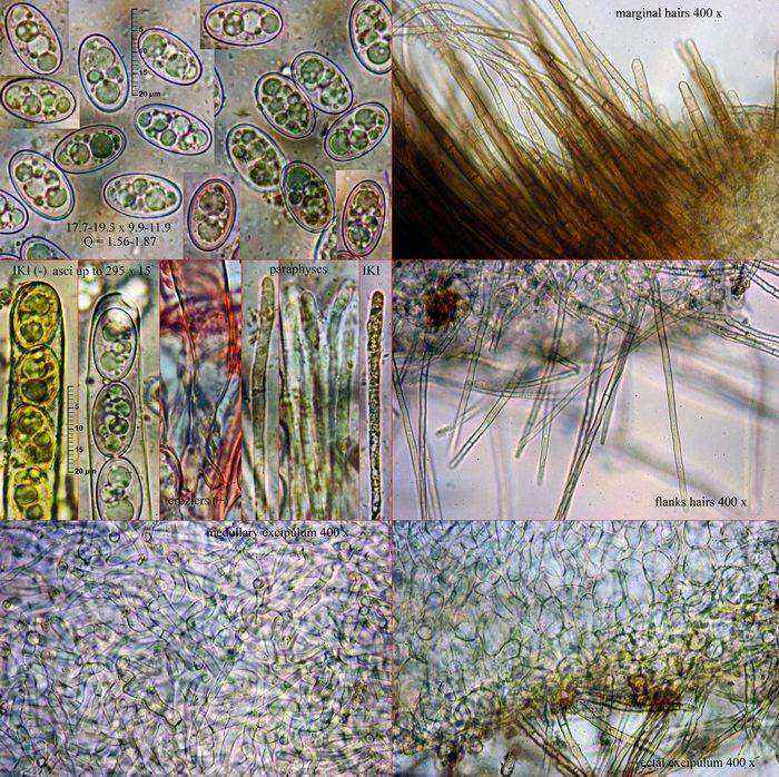 macrostoma