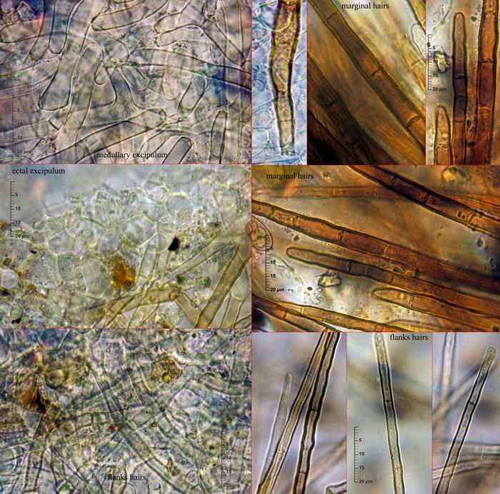 macrostoma