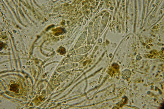 macrostoma