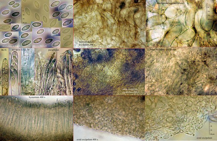macrostoma