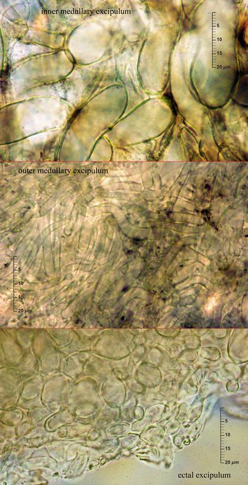 macrostoma