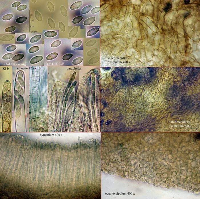 macrostoma