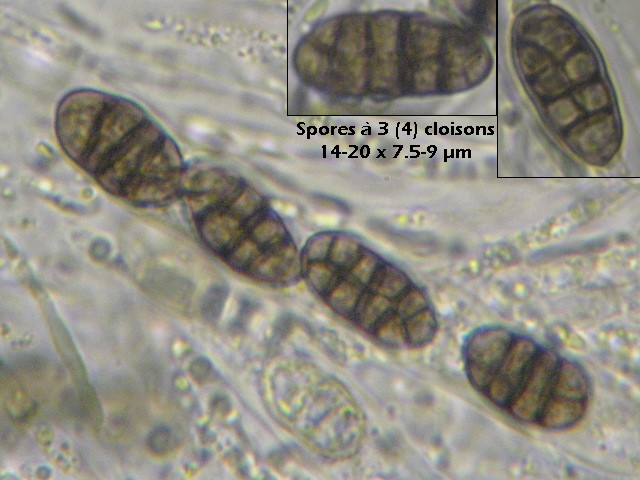 macrostoma