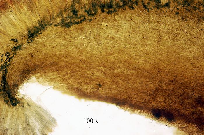 macrostoma