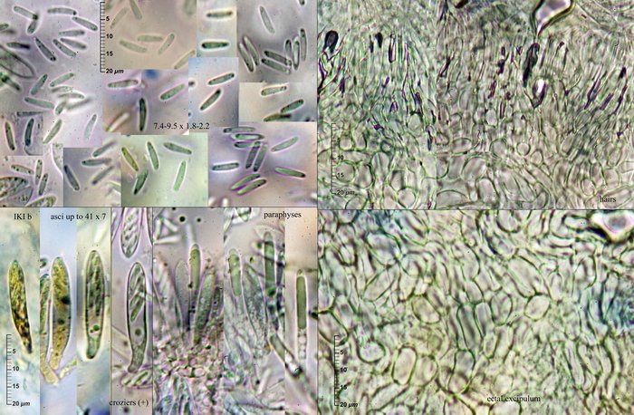 macrostoma