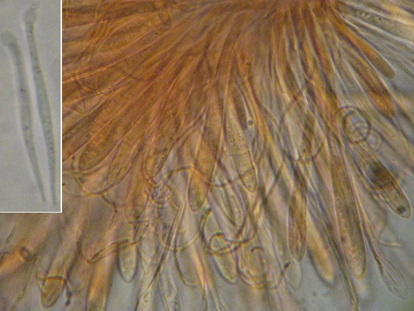 macrostoma