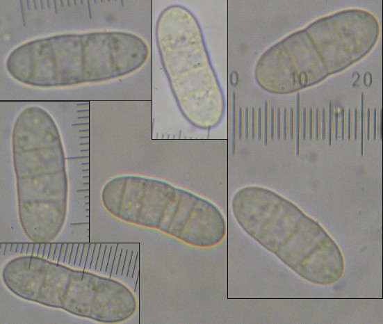 macrostoma