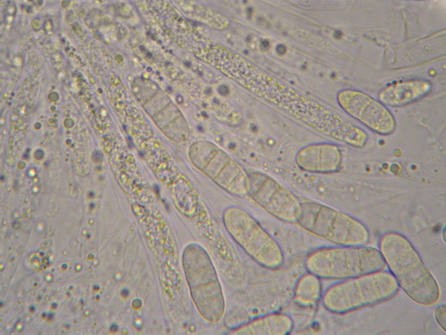 macrostoma
