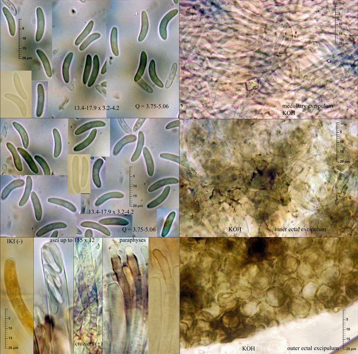 macrostoma