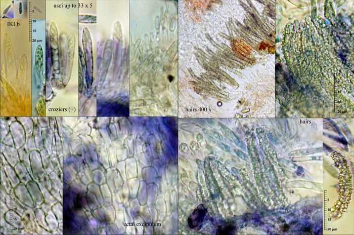 macrostoma