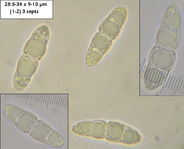 macrostoma