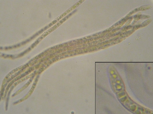 macrostoma