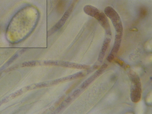 macrostoma