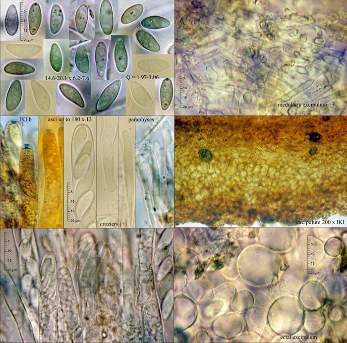 macrostoma