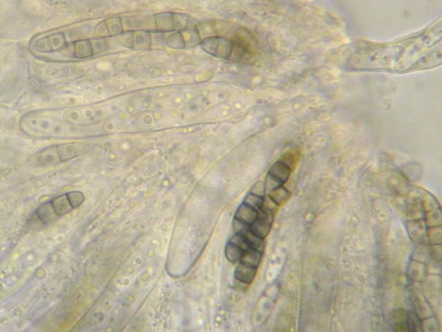 macrostoma