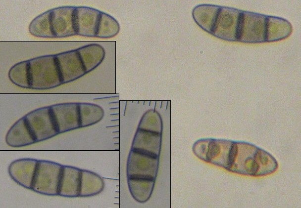 macrostoma
