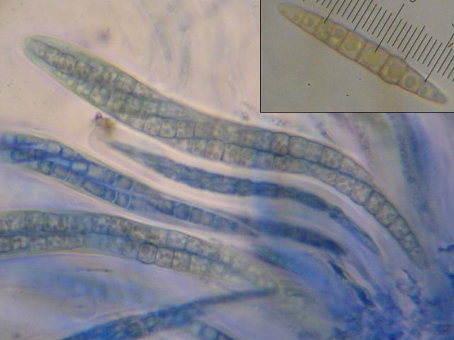 macrostoma