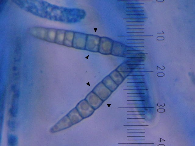 macrostoma