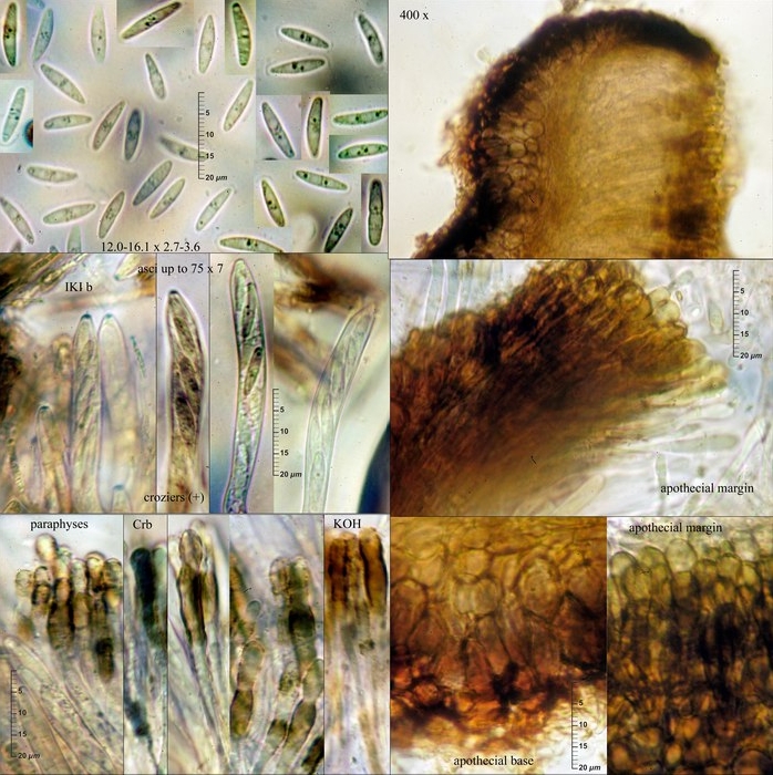 macrostoma