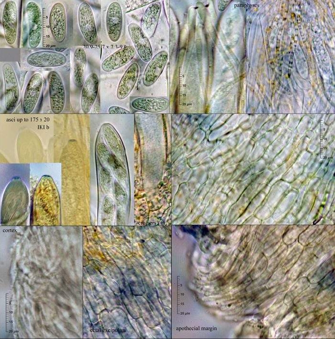 macrostoma