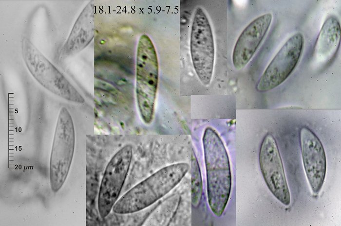 macrostoma