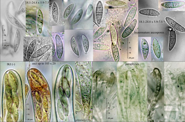 macrostoma