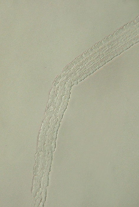macrostoma