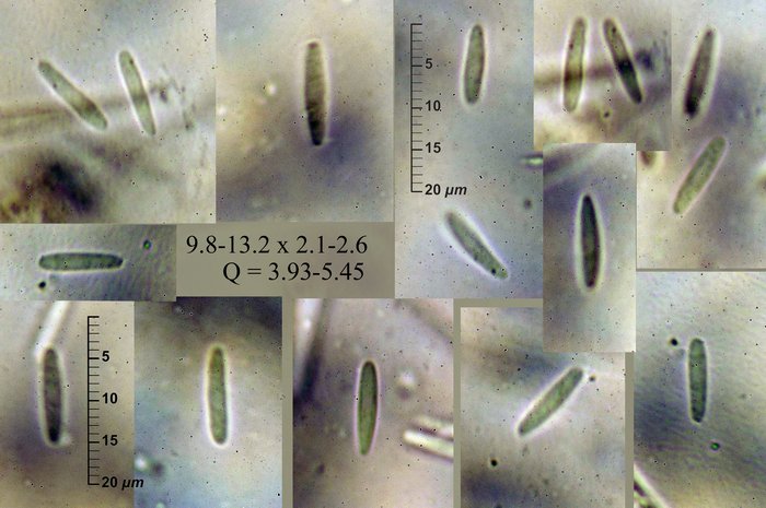 macrostoma