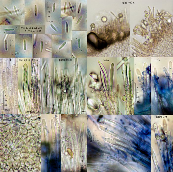 macrostoma