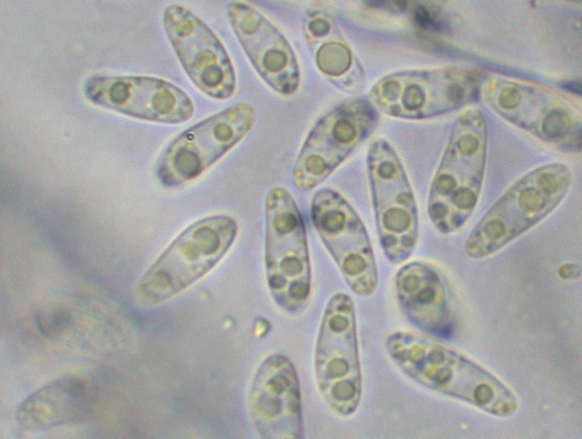macrostoma