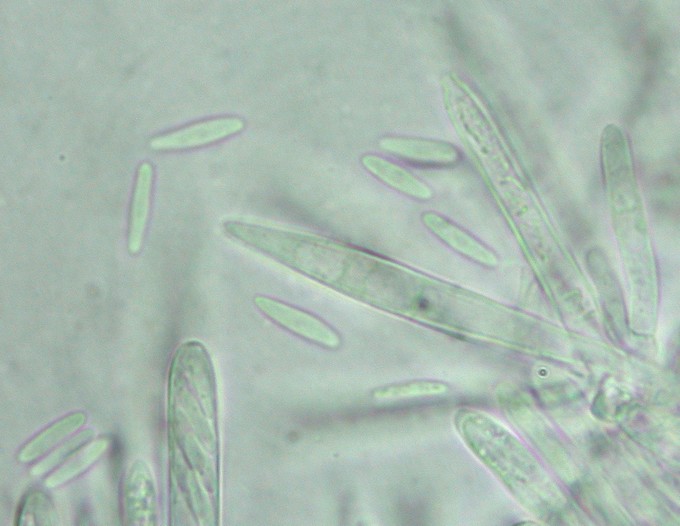 macrostoma